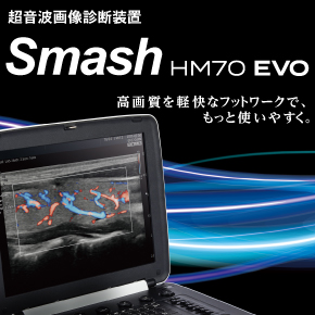 Smash HM70 EVO