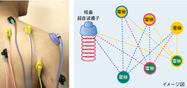 アクロトーンの電極間相互通電システム
